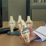 Do I Need a Knee Replacement Surgeon in Manchester for Severe Knee Pain?